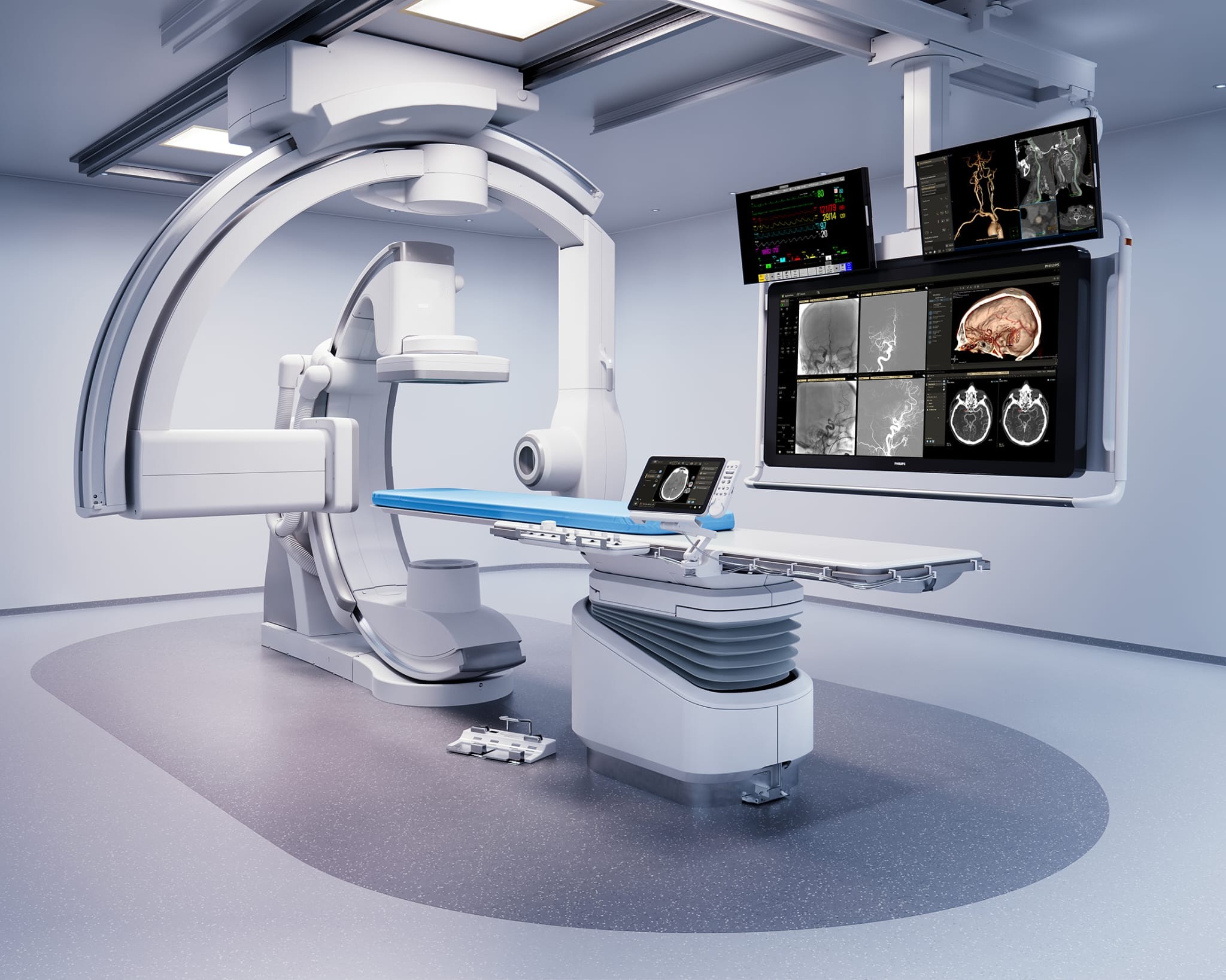Dotarea SJU Bacău cu echipamente medicale care diagnostichează și tratează pacient critic cu patologie vasculară cerebrală acută